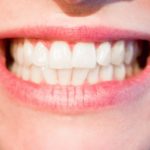 Śliczne zdrowe zęby dodatkowo świetny uroczy uśmieszek to powód do zadowolenia.